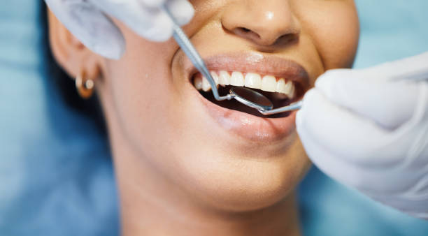Best Emergency Root Canal Treatment in Danvers, IL